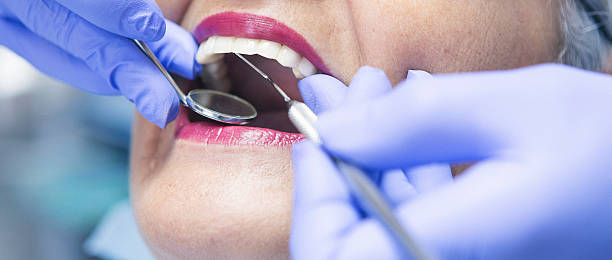 Best Emergency Wisdom Tooth Extraction in Edmond, OK